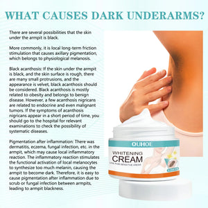 Private Parts Whitening Cream