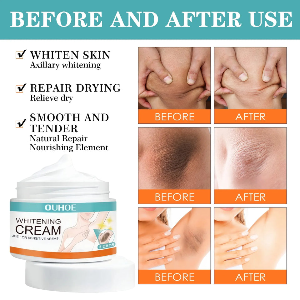 Private Parts Whitening Cream