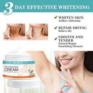 Private Parts Whitening Cream
