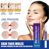 Wart Remover Gel Pen Fast & Effective